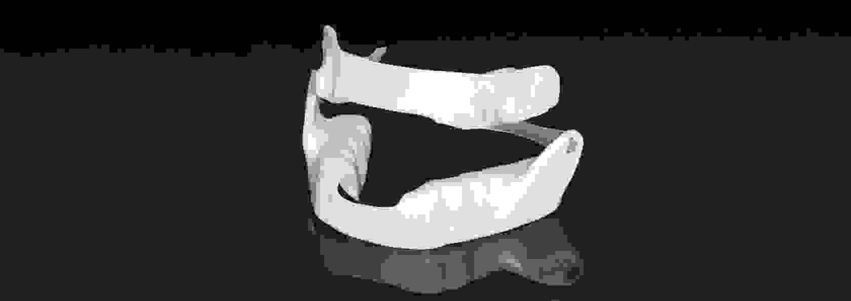 Unterkieferprotrusionsschiene Schnarchschiene